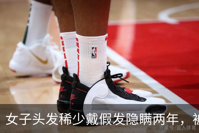 女子头发稀少戴假发隐瞒两年，被发现后男友要求分手